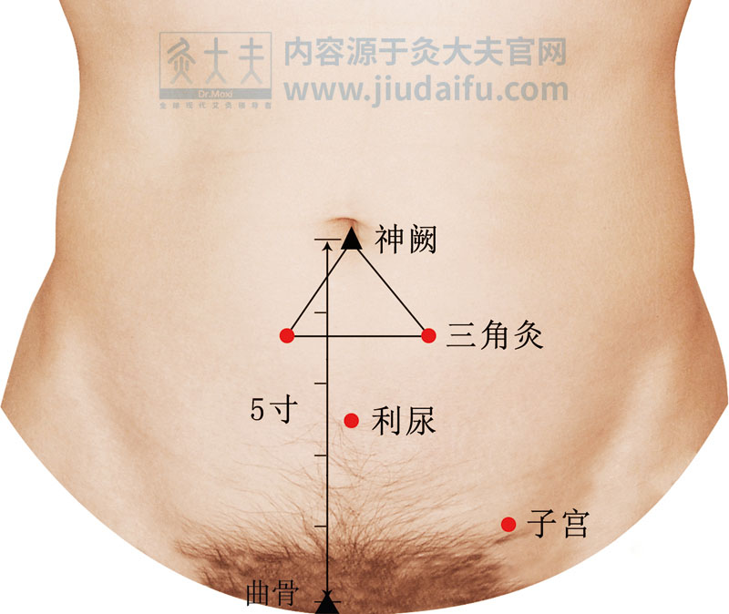 %e4%b8%89%e8%a7%92%e7%81%b8%e5%88%a9%e5%b0%bf%e5%ad%90%e5%ae%ab_opt